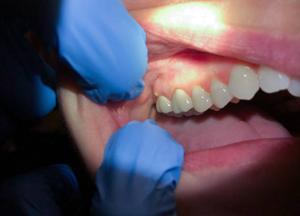 Best Emergency Cosmetic Dentistry (e.g., broken veneers) in Southgate, KY